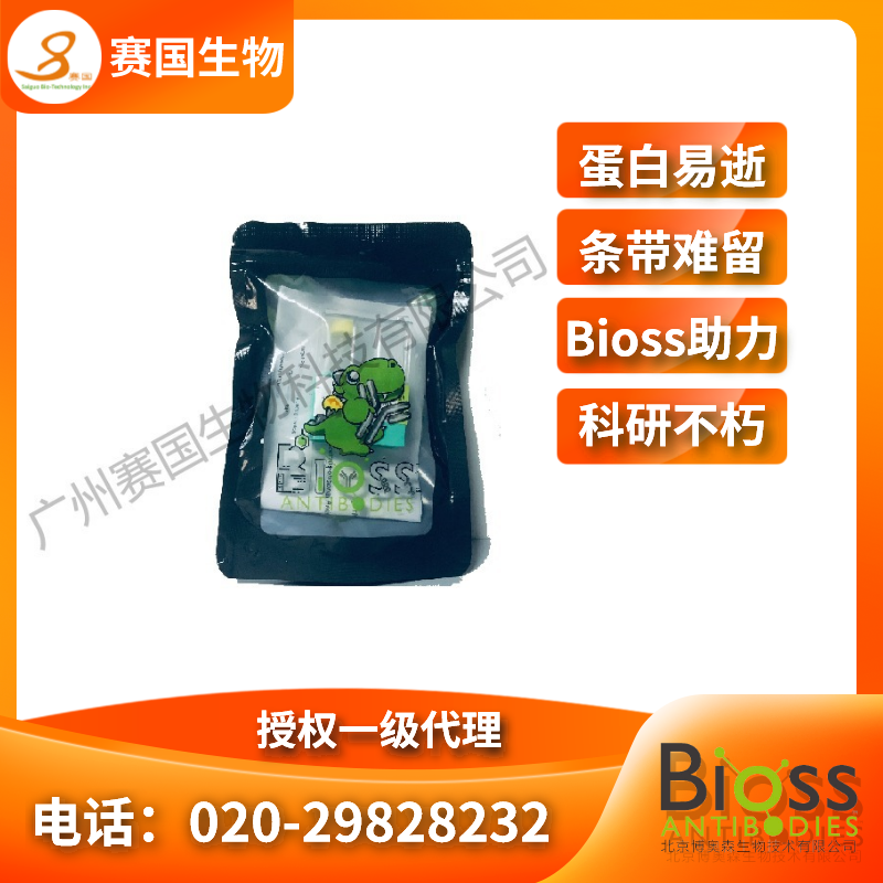 核心結(jié)合因子α1/成骨特異性轉(zhuǎn)錄因子/Cbfα1抗體  |  RabbitAnti-RUNX2 antibody 核心結(jié)合因子α1/成骨特異性轉(zhuǎn)錄因子/Cbfα1抗體  |  RabbitAnti-RUNX2 antibody